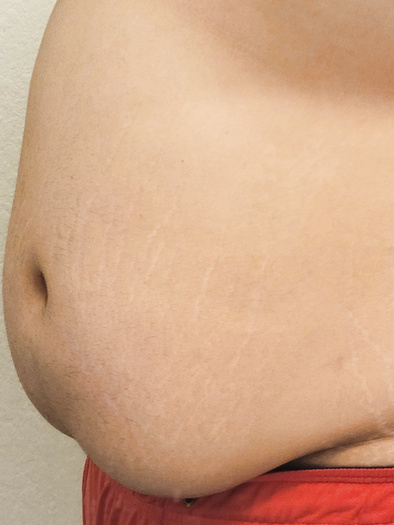 Just a pic of my tummy i thought i'd share