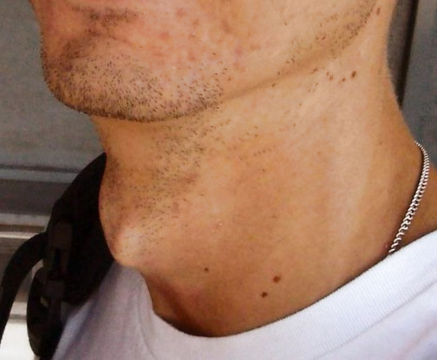 Adam’s apple sexy hot good