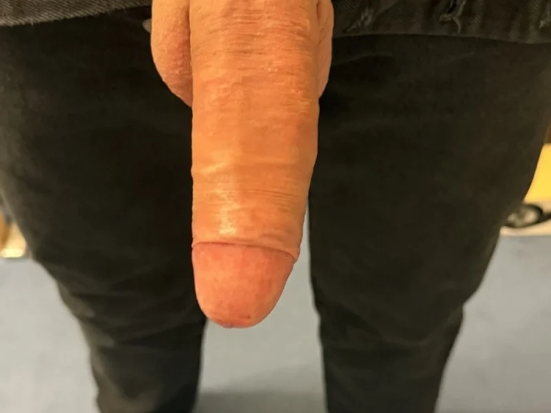 My newest 501 93: 27 nude pics